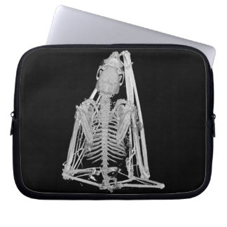 Skrämmande gotisk fladdermus-skelett laptop sleeve