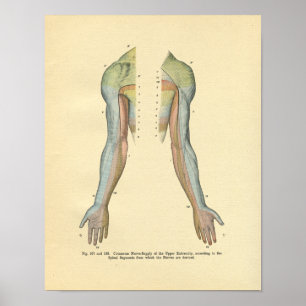 Skriv ut Arm Kutan Nerve Innervation Poster