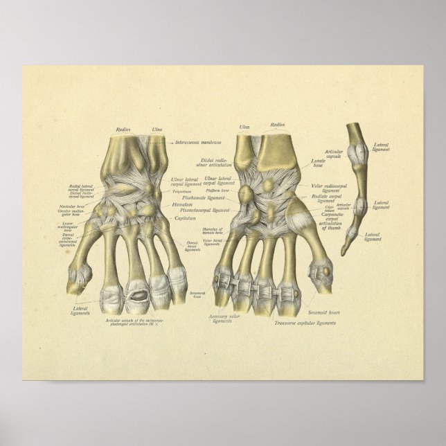 Skriv ut hand Wrist Finger Anatomy Bones Poster (Framsidan)