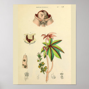 Skriv ut med Fetus Position Uterus Vintage Anatomy Poster