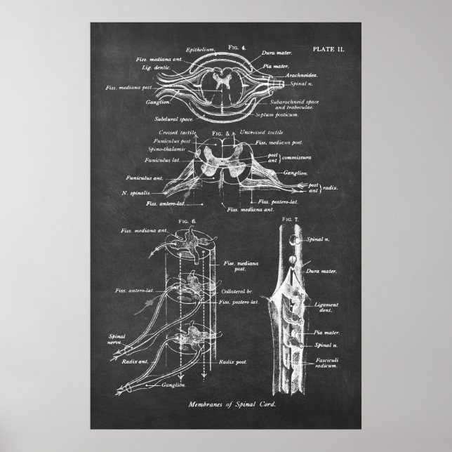 Skriv ut nr 3 poster (Framsidan)