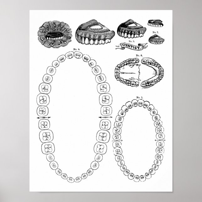 Skriv ut Poster av antika tandtanddiagram (Framsidan)