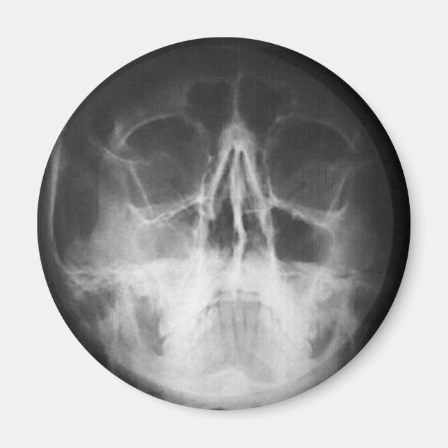 Skully Top Roligt Magnet (Framsidan)