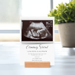Snart kommer Sonogram Gravid Baby Shower<br><div class="desc">Det är alltid en bra att  den spännande nyheten med närmaste och djupaste. Anpassa detta genom att ladda upp ultraljudsskanningen,  lägg till information och visning vid duschen.</div>