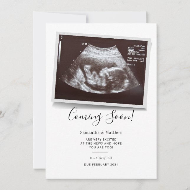 Snart kommer Ultrasound Sonogram-Gravid Meddelande (Framsida)