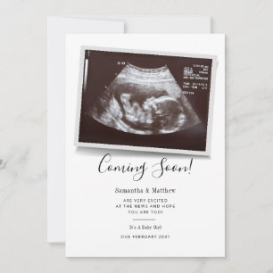 Snart kommer Ultrasound Sonogram-Gravid Meddelande