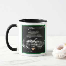 Sonogram Baby kommer snart att tillkännages för Mo Mugg