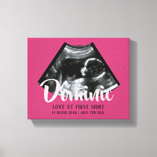 Sonogram KeepsakBaby Ultrasound Kanvastryck