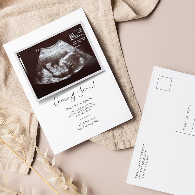 Sonogram Typography Ultrasound Photo Gravid Meddelande Vykort (Skapare uppladdad)