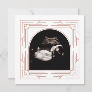 Söt Rosa Ram Baby sonogram foto  Meddelande