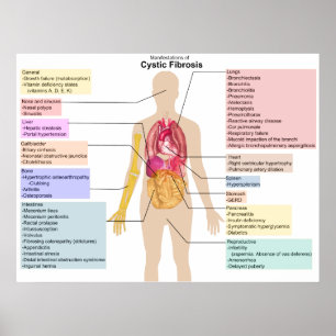Specificerat kartlägga av tecknen av Cystic Poster