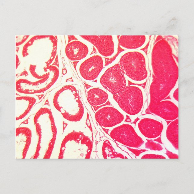 Spetsar under mikroskop vykort (Framsida)