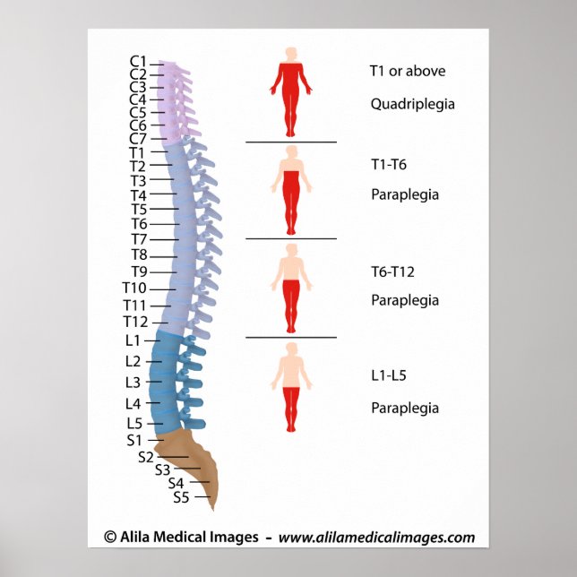 Spinal cord injury levels, labeled drawing. poster (Framsidan)
