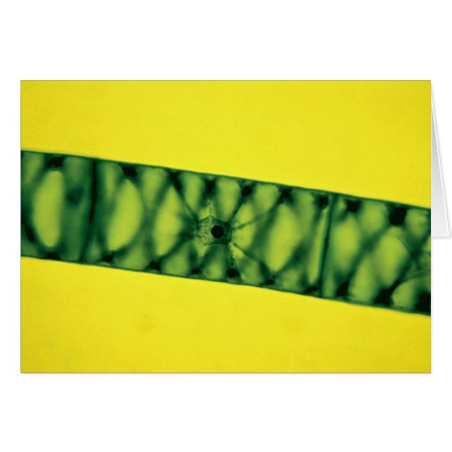 Spirogyra Grönt Algae Hälsningskort (Framsidan Horizontal)