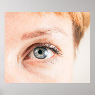 Stängning av öga poster