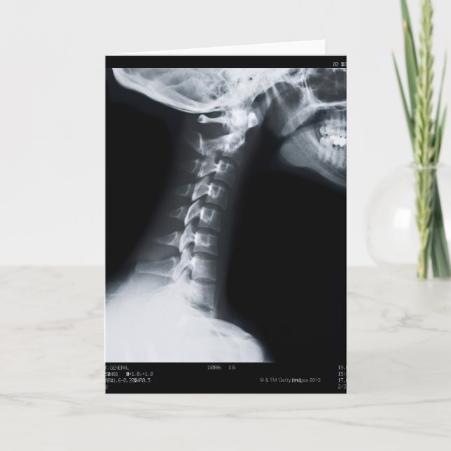 Stråle X av nackekotor fäller ned däribland käken Kort (Framsida)