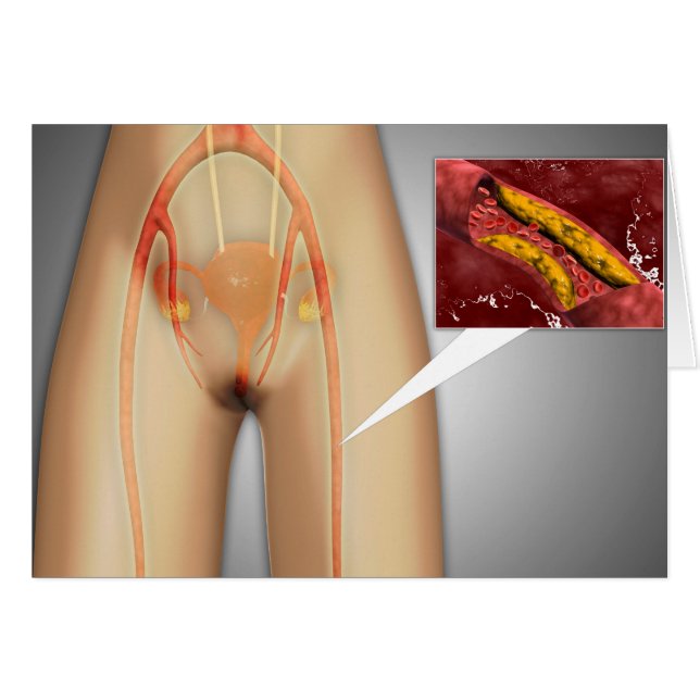 Strimmad artär nära hörlursstängning hälsningskort (Framsidan Horizontal)