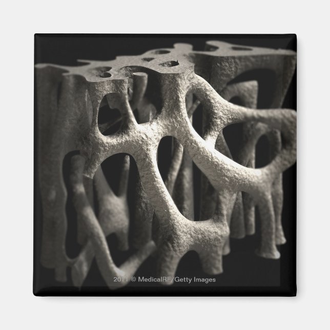 Struktur av ben med osteoporos magnet (Framsidan)