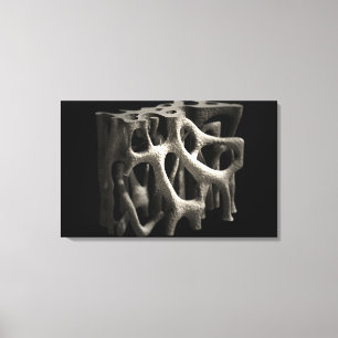 Strukturera av ett ben med osteoporosis canvastryck