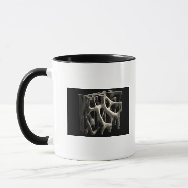 Strukturera av ett ben med osteoporosis mugg (Vänster)
