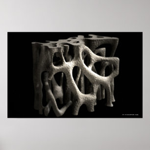 Strukturera av ett ben med osteoporosis poster