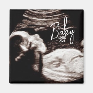 Svart och vitt Baby Ultrasound Birth-meddelande Magnet