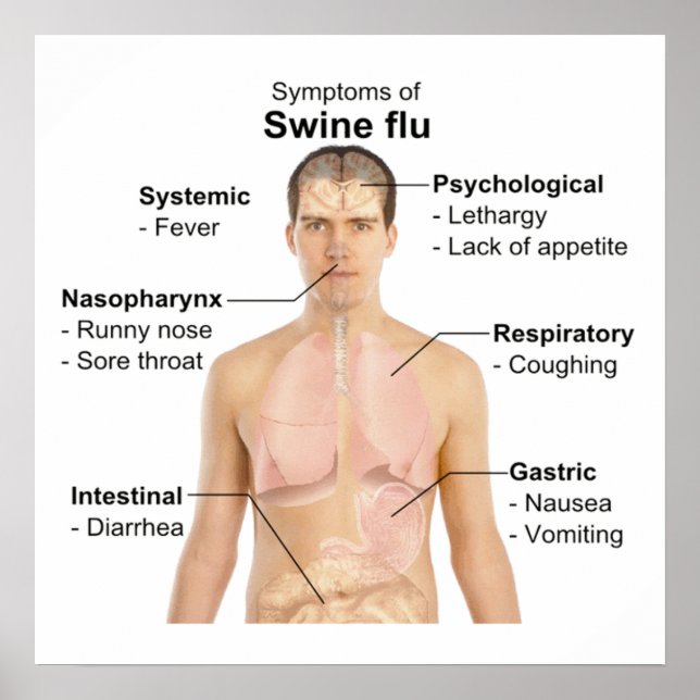 Swine Flu Poster (Framsidan)