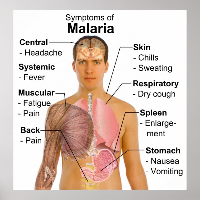 Symptomdiagram över musketopatonborne-Malaria-sjuk Poster (Framsidan)