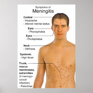 Symtom Diagram över inflammationssjukdom Meningit Poster