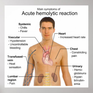 Symtom på akut hemolytisk transfusionsreaktion poster