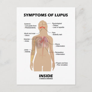 Symtom på Lupus inre (autoimmun sjukdom) Vykort