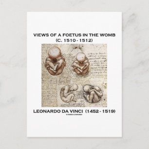 Synpunkter på ett initiativ i Womb (Leonardo da Vi Vykort