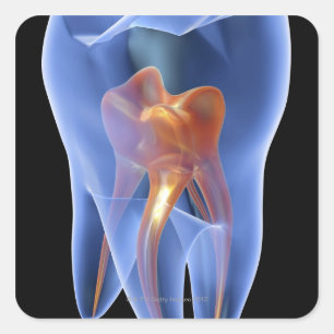 Tand, genomskinlig kor-del av en molar fyrkantigt klistermärke