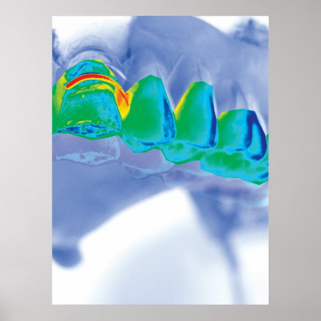 Tanddesigndentist Orthodontist Poster (Framsidan)