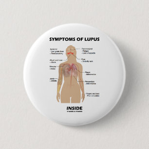 Tecken av Lupusinsida (Autoimmune oordning) Knapp