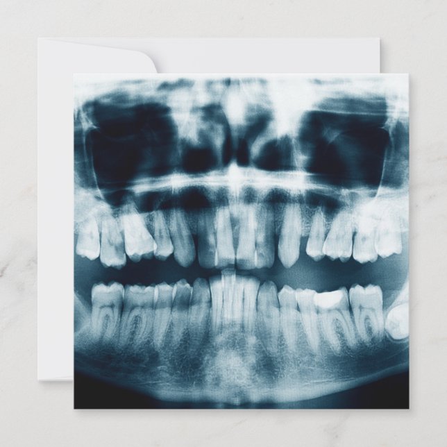 Teeth X-ray (Framsida)