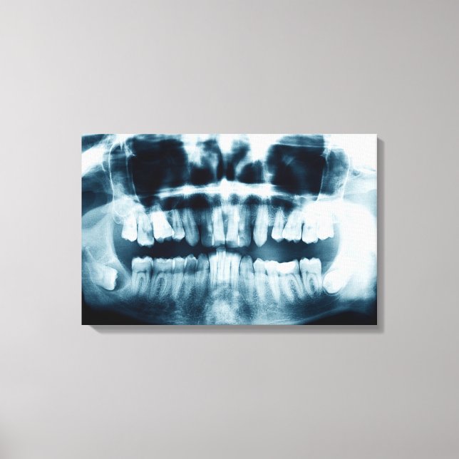 Teeth X-ray Canvastryck (Framsida)
