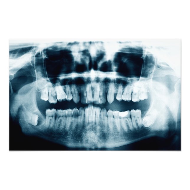 Teeth X-ray Fototryck (Framsidan)
