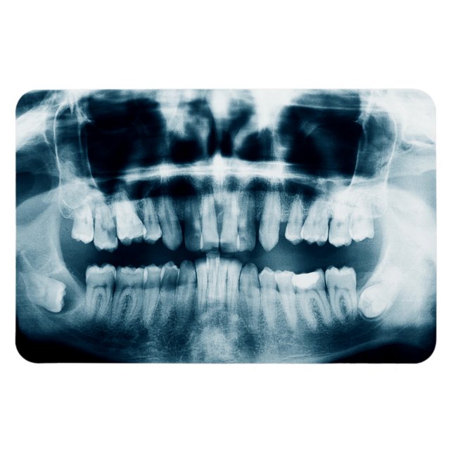 Teeth X-ray Magnet (Horisontell)