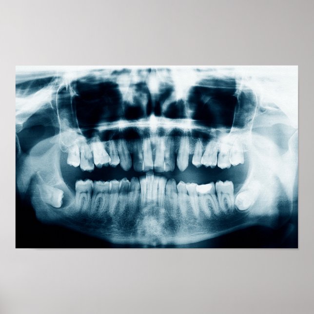 Teeth X-ray Poster (Framsidan)