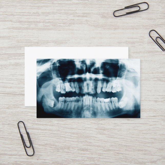 Teeth X-ray Visitkort (Fram/Back In Situ)