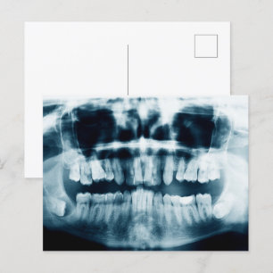 Teeth X-ray Vykort