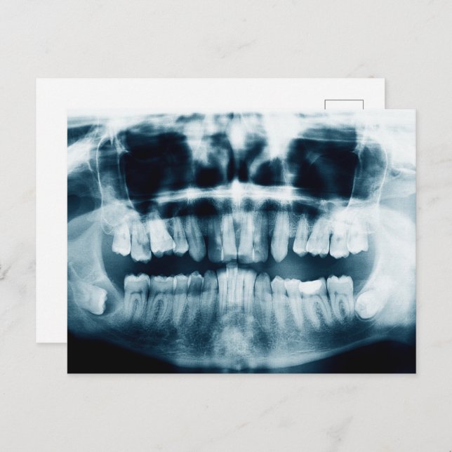 Teeth X-ray Vykort (Fram/baksida)