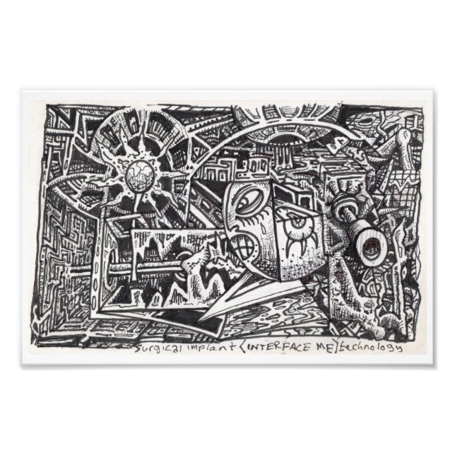 Teknik för kirurgisk implantation (gränssnitt till fototryck (Framsidan)