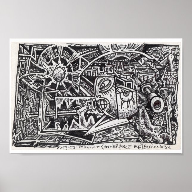 Teknik för kirurgisk implantation (Interface Me). Poster (Framsidan)
