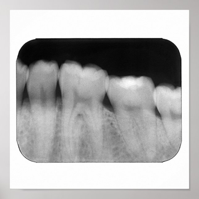 Teth med fyllning poster (Framsidan)