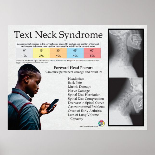 Textens Nacke-smärtsyndrom Poster (Framsidan)