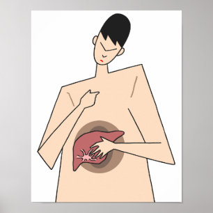 Tidig upptäckt av leversjukdom. poster