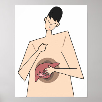 Tidig upptäckt av leversjukdom. poster