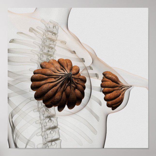 Tillnärmning av kvinnliga bröstkörtlar poster (Framsidan)